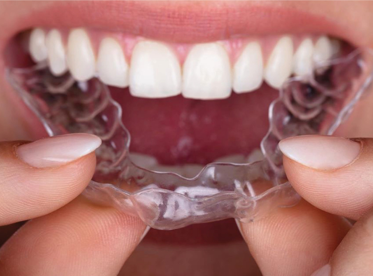 Invisalign Braces: Clear Aligners. Teeth Straightening. Invisible