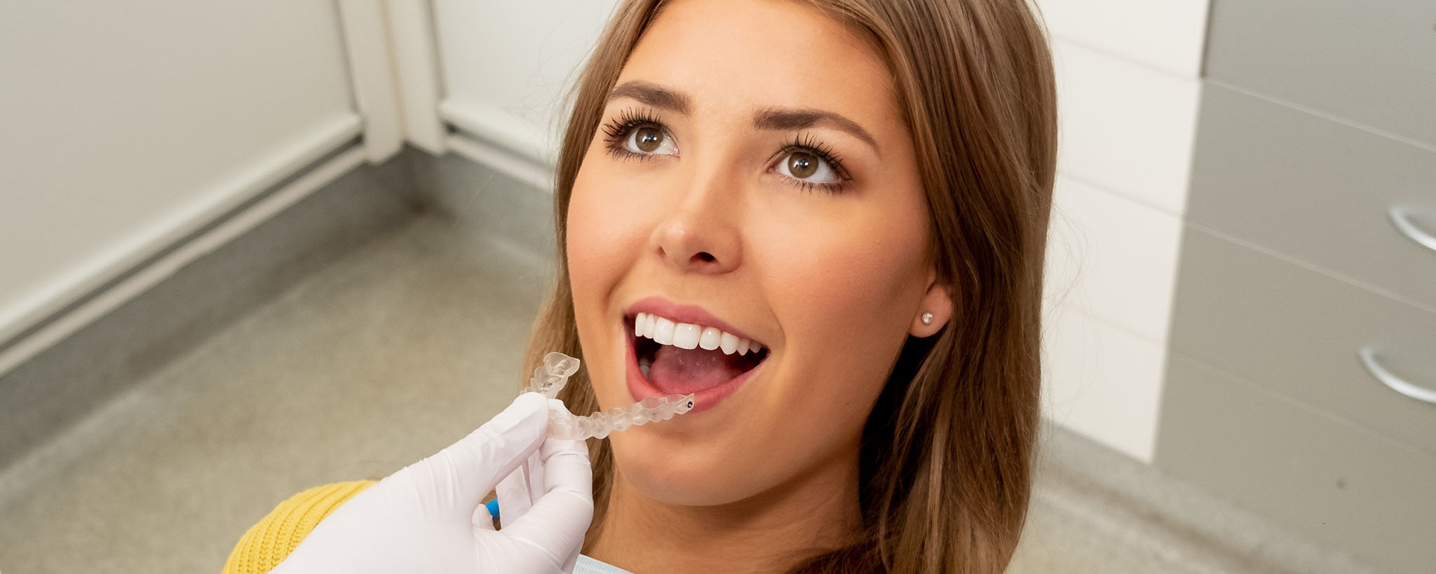 8 things to know before getting Invisalign
