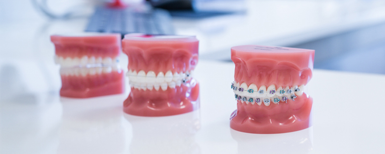 Braces Colours Choosing The Right One « Smile Team Orthodontics Blog