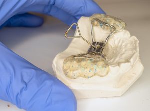 Palate Expanders: How They Work, Who Needs Them, and What to Expect ...