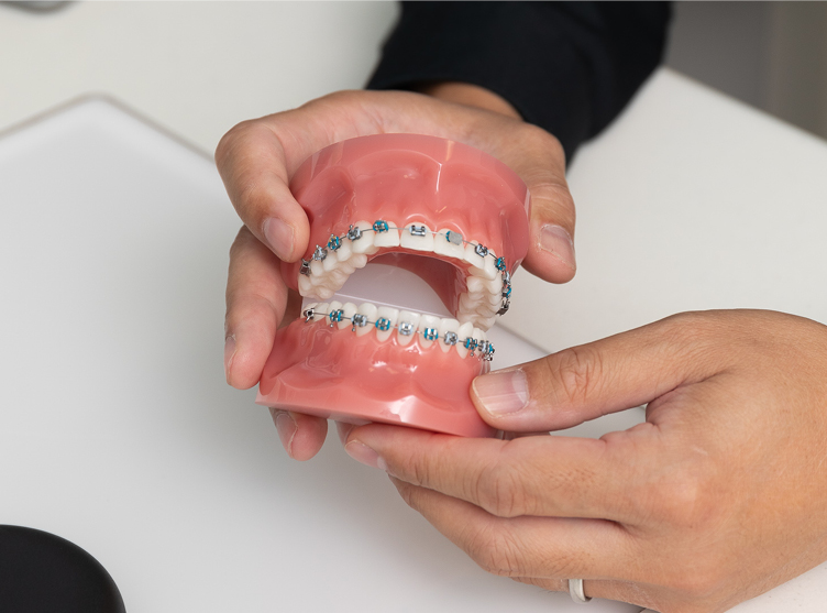 Metal Braces: Should You Go Traditional? « Smile Team Orthodontics